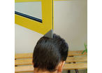 Windows corner ANGL’ISOL®