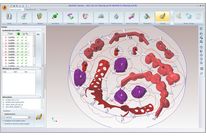 CAD/CAM Software Solution - WorkNC Dental